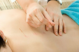 How does Acupuncture work?