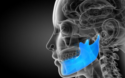 Acupuncture for TMJ Disorder: An Effective, Natural Treatment Option